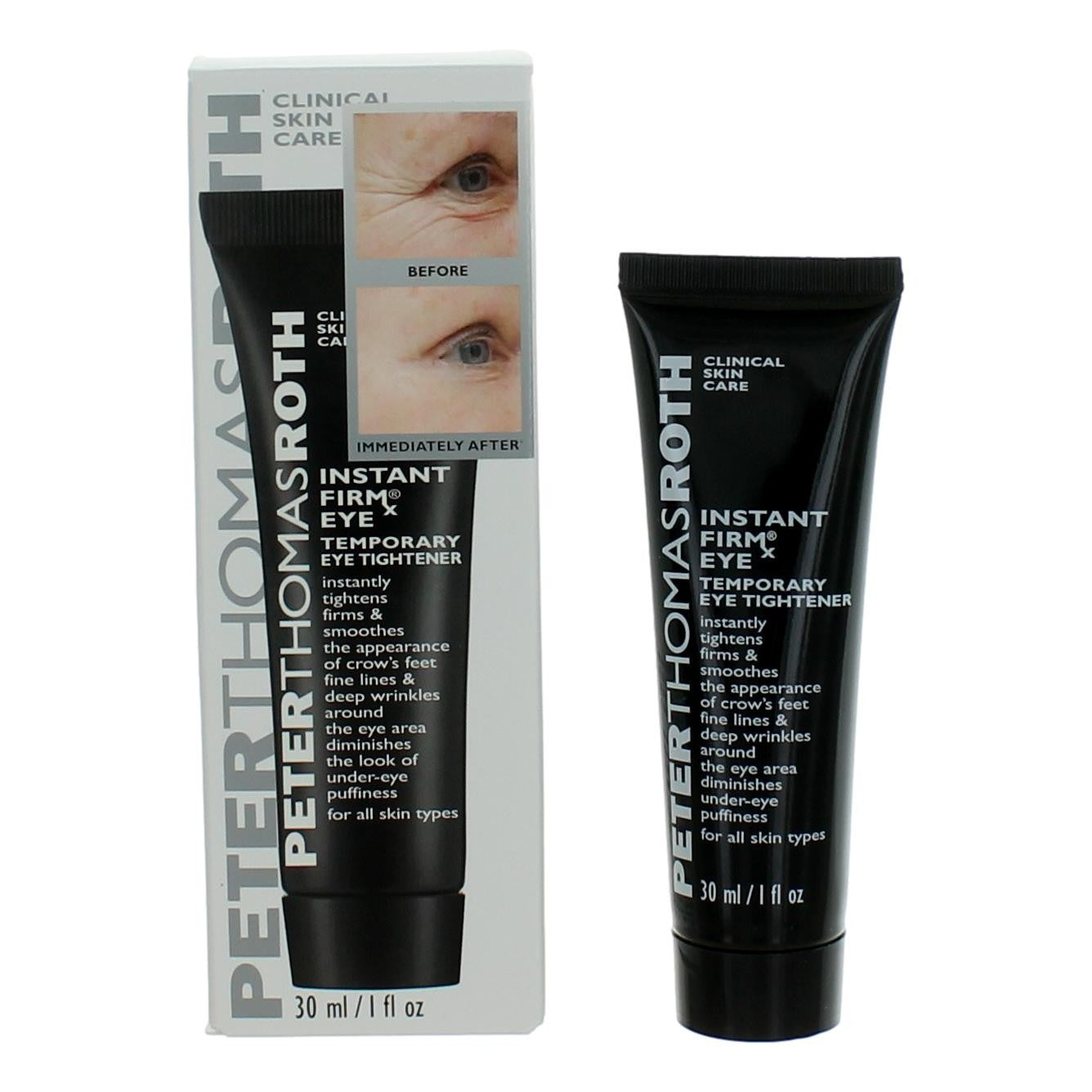Peter Thomas Roth Instant FIRMX 1 oz Temporary Eye Tightener